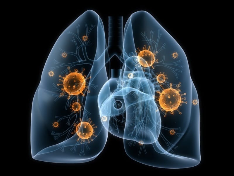 Rokok elektrik meningkatkan resiko pneumonia