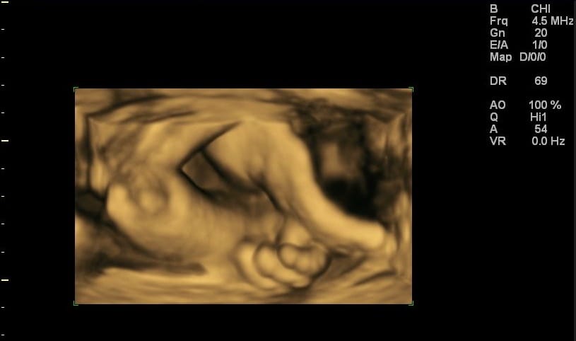 http://www.ultrasound-images.com/