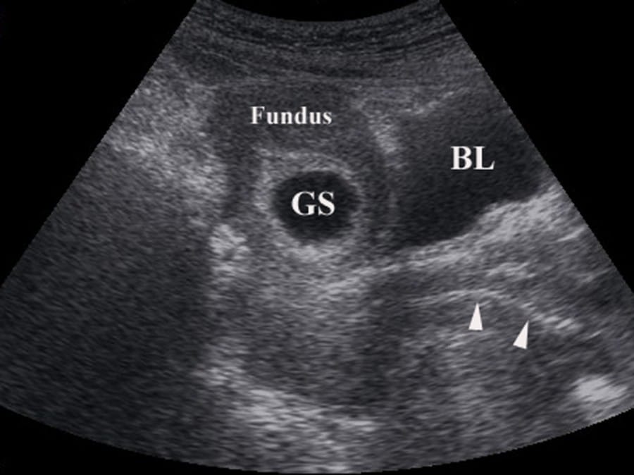 www.emergencyultrasoundteaching.com