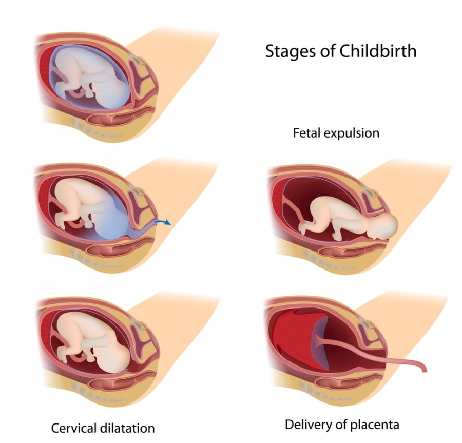 Tahap Pengeluaran Plasenta - Proses Melahirkan Bayi Normal