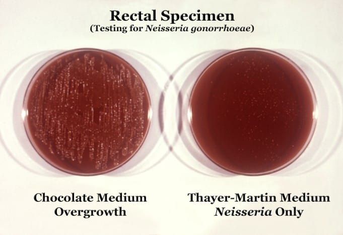 bakteri gonorrhea