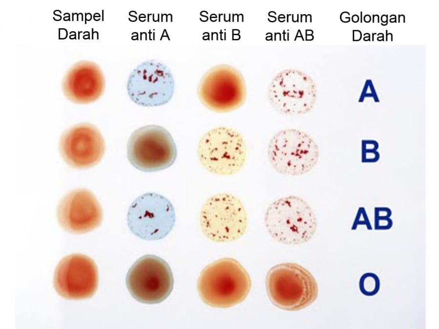 transfusi menurut golongan darah