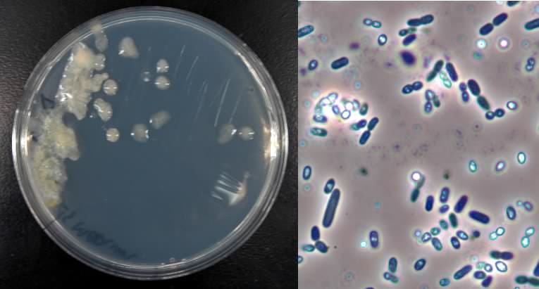 azotobacter