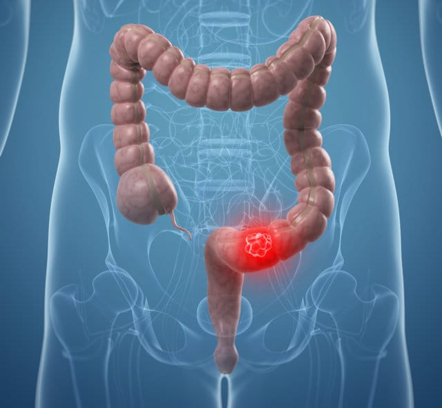 organ pencernaan manusia usus besar